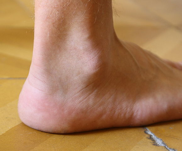 Legacy News: the “Achilles Tendon” Does Not Exist